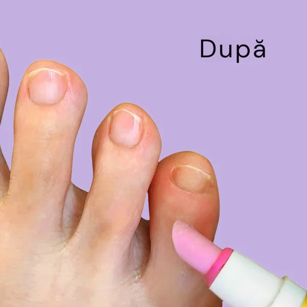 NailGloss - Cuticule catifelate și îngrijite în câteva secunde