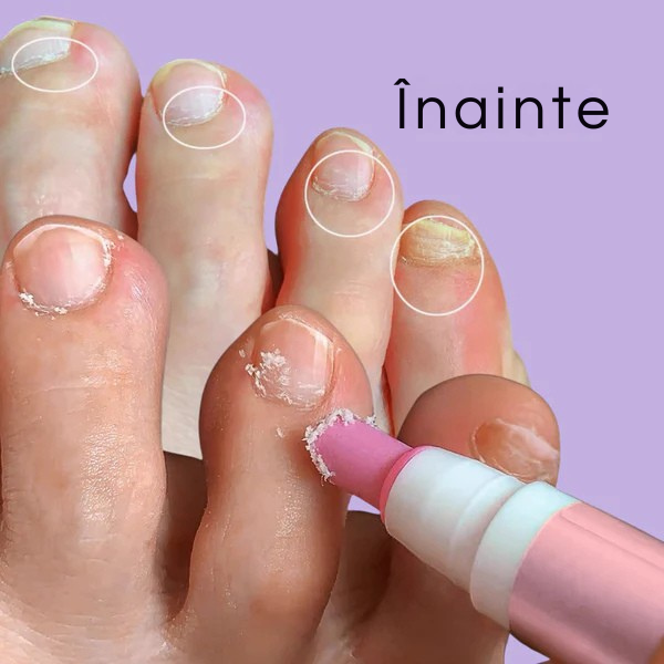 NailGloss - Cuticule catifelate și îngrijite în câteva secunde